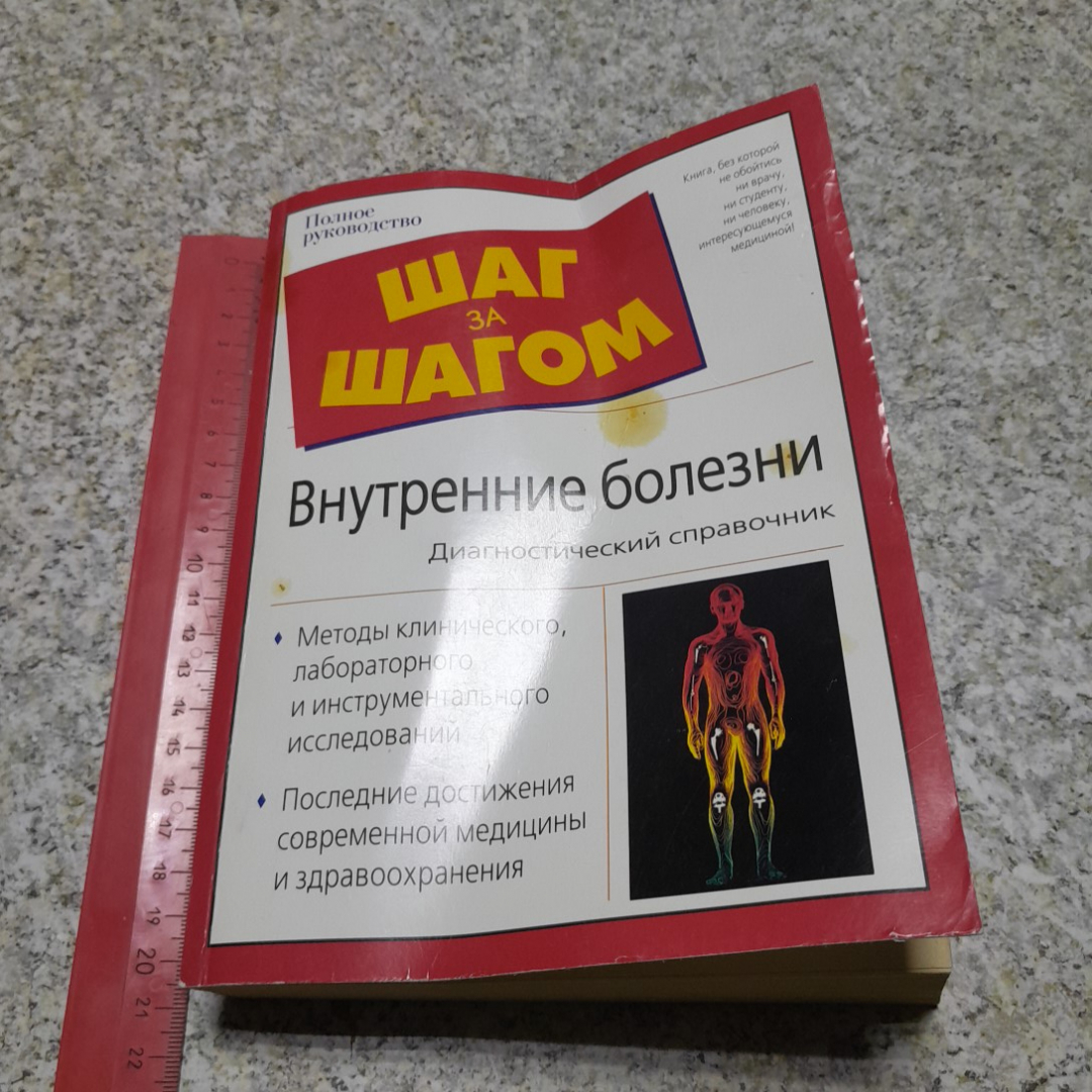 Внутренние болезни • Диагностический справочник И.А.Бережнова, Е.А.Романова 2005г.. Картинка 9